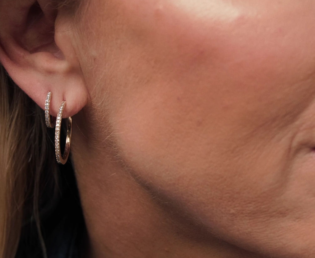 Alba Medio 14K Guld Hoop m. Lab-Grown Diamanter